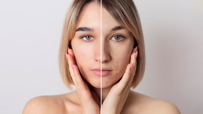 Craving A Well Rested Appearance? Here&rsquo;s The Ultimate Guide For Reviving Worn Out Looking Skin